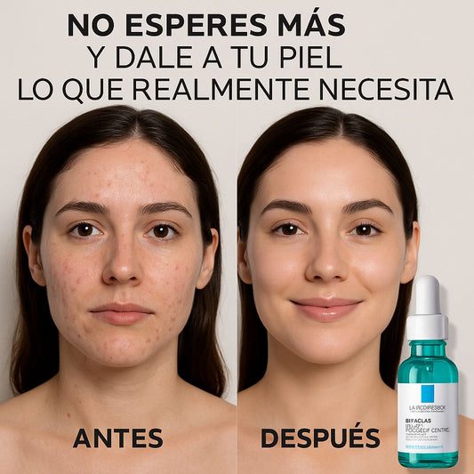 Serum Ultra Concentrado La Roche-Posay Effaclar 30 ml